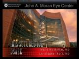 Simultaneous iris-sutured IOL implantation and DSAEK