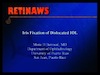 Iris Fixation of Dislocated IOL