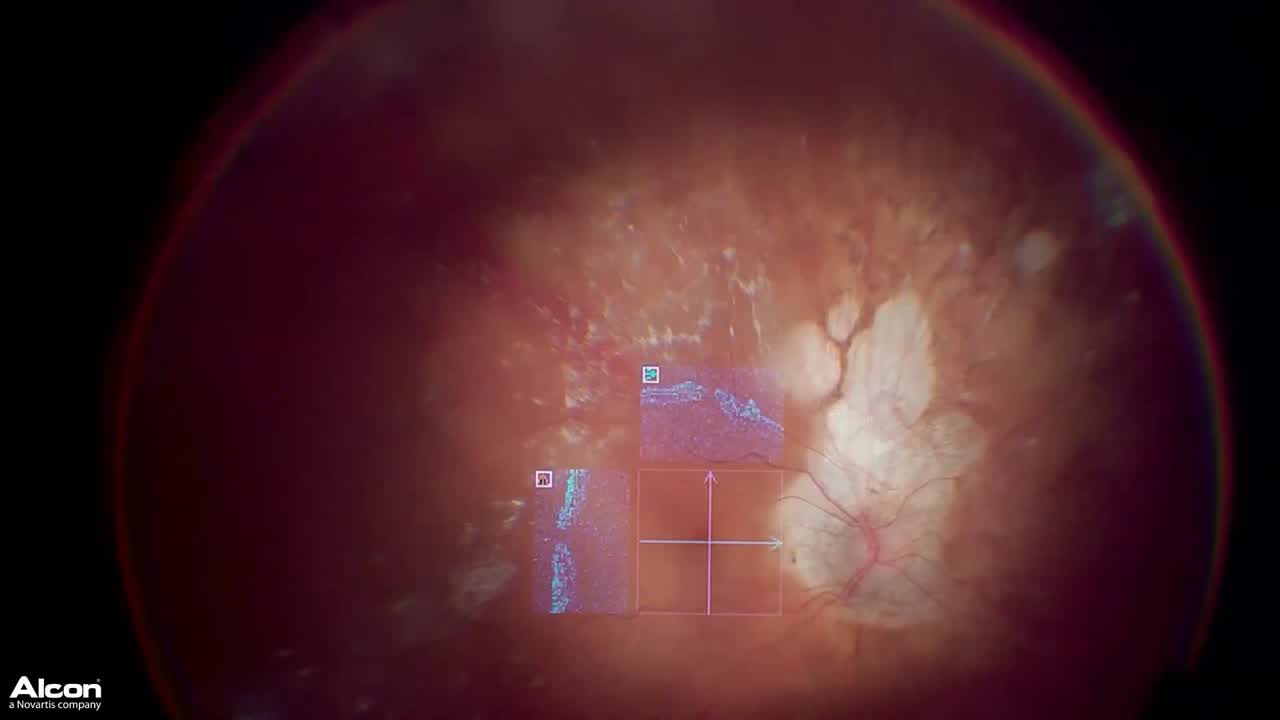High Magnification Performance