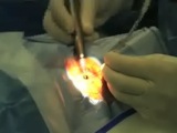 Low Cost I/A