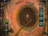 Refractive Lens Exchange in a Patient with Significant Corneal Astigmatism
