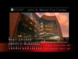 Multi-Layered Amniotic Membrane Transplantation