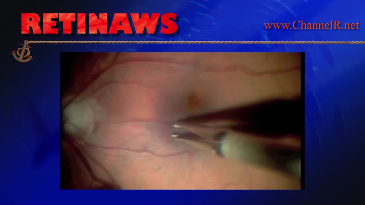 Thumbnail for fpkam