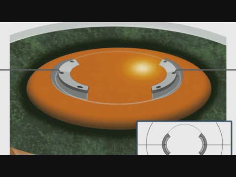 A New Device to Increase Endocapsular Support During Phacoemulsification in Cases of Localised Zonular Weakness