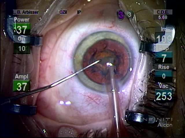 Residual Nuclear Fragment