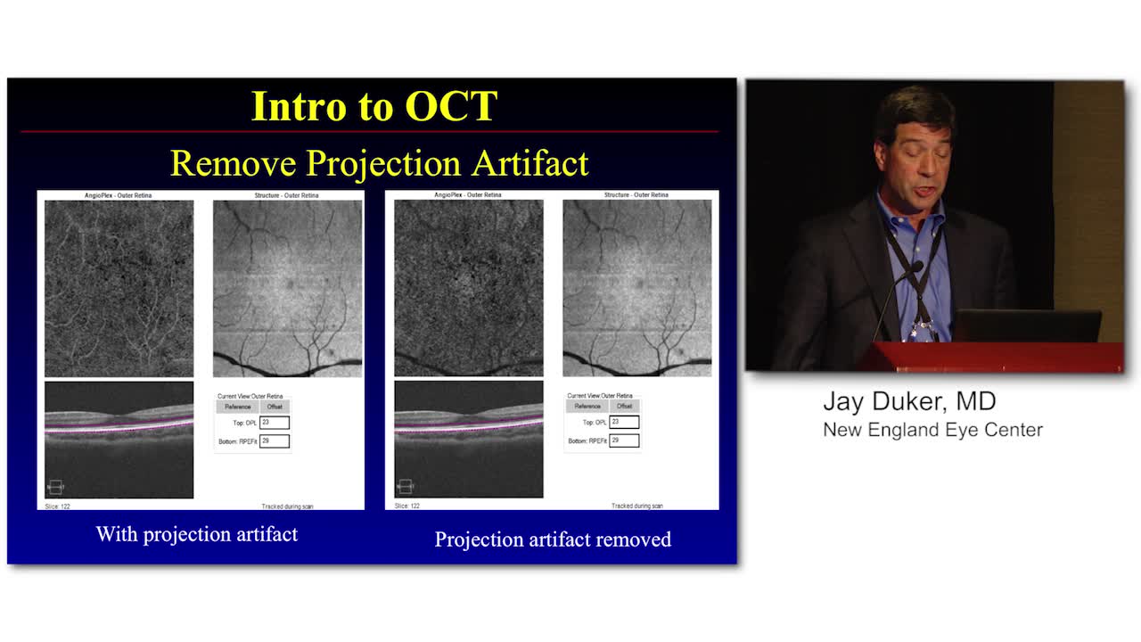 Why OCT-A is Useful for Today's Retina Practice?