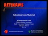 Subretinal Lens Material