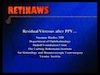 Residual Vitreous after PPV