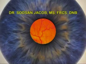 Nucleus Drop and ACIOL Scaffold