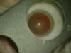 Astigmatic Reduction: Keratotomy