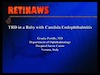 TRD in Baby with Candidia Endophthalmitis