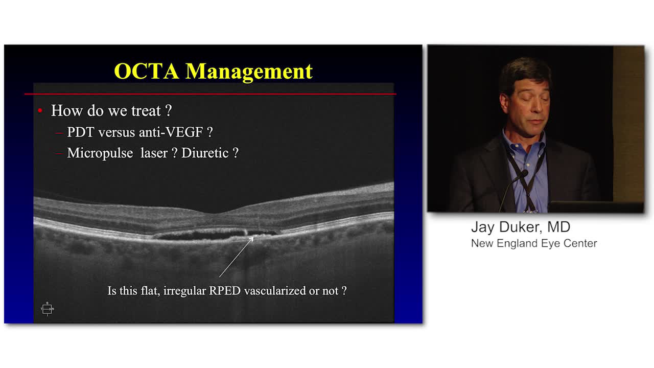 Case Report: OCT-A Findings in a Case of Central Serous Retinopathy