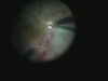 Journey Through the Normal Day of a Retina Surgeon