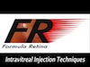 Intravitreal Injection Techniques