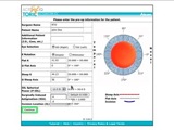 How to Use the AcrySof Toric Calculator