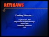 Frothing Vitrector