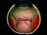 Cutting
