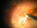 Worm Dancing on the Retina