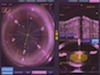 A Typical LenSx Laser Procedure