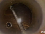 Suturing a PCIOL with Microendoscope