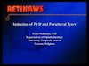 Induction of PVD and Peripheral Tears