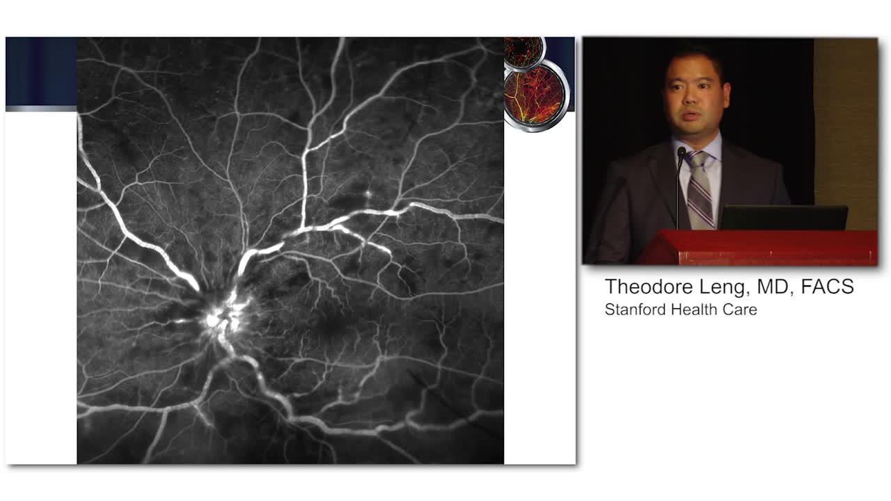 OCT-A in the Management of Retinal Vascular Occlusion 