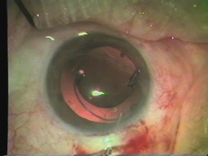 Old Teaching Tape: Precision Cosmet
