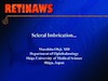 Scleral Imbrication