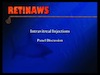 Intravitreal Injections