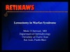Lensectomy in Marfan Syndrome