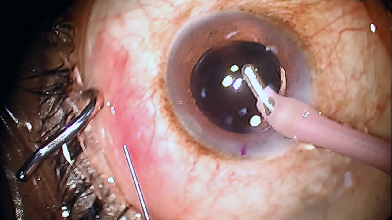 Xen Implantation: Using the New Loading System