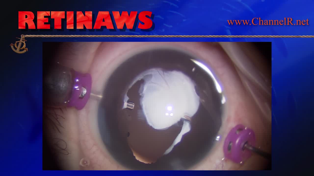 Thumbnail for hnyix