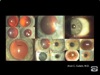 Art of Vision Surgery