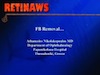 FB Removal