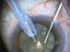 Distilled H2O Damage 