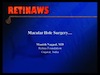 Macular Hole Surgery