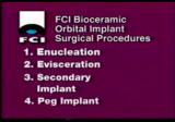 Secondary Implant