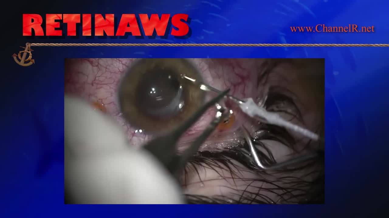 Thumbnail for hpwih