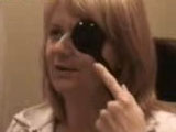 Dislocated Crystalens and Zonular Dialysis