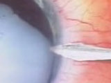 Thumbnail for huruha