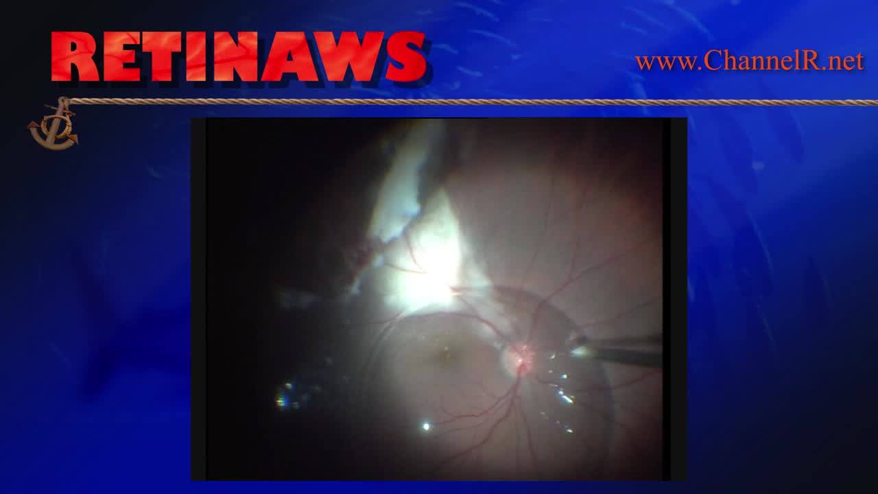 Thumbnail for hvbog