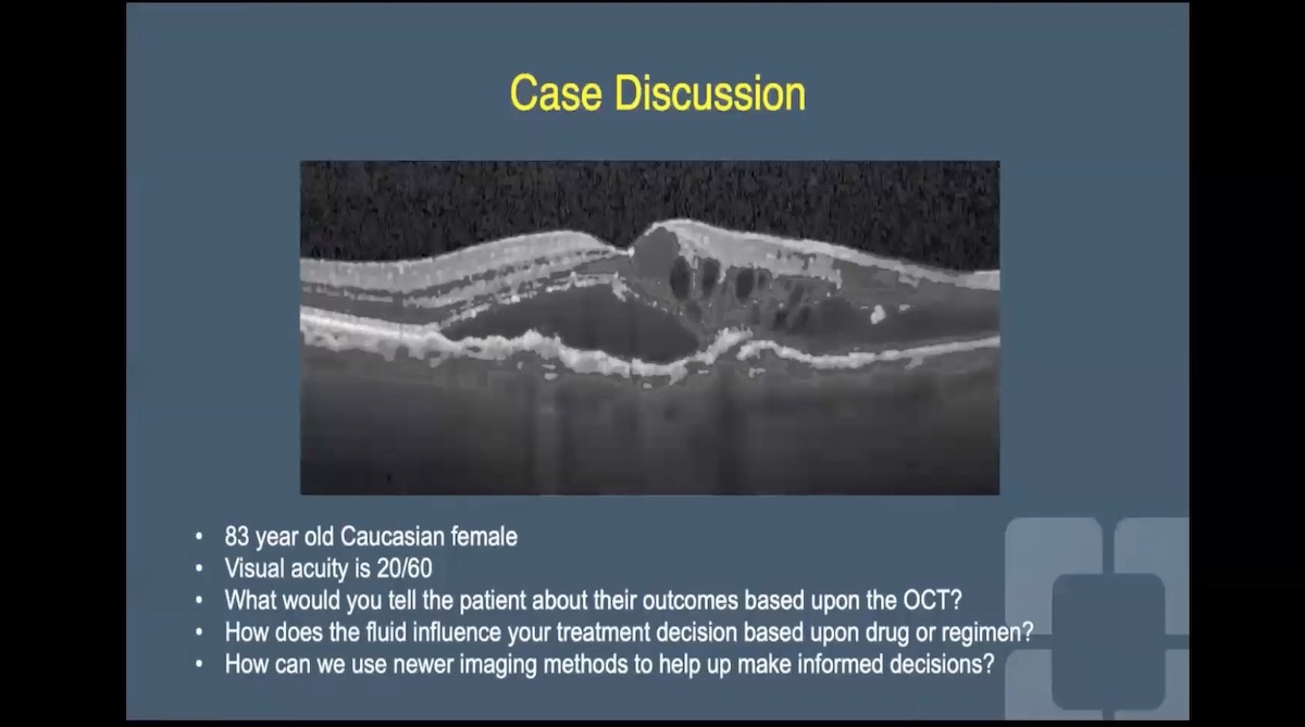 Retinal Case Series
