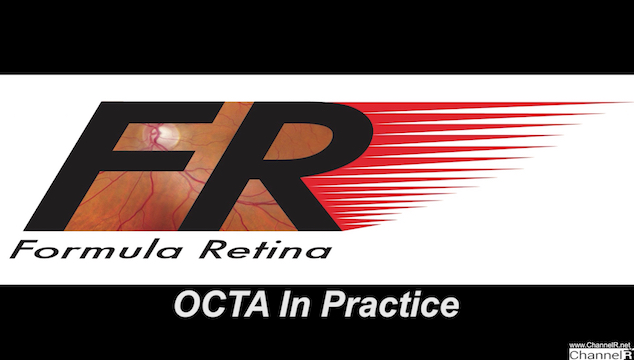 OCTA In Practice
