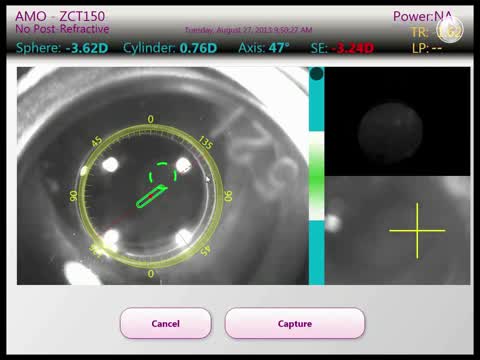 ORA System Presents: VerifEye