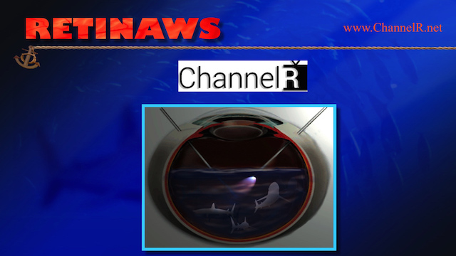 Retinaws OIC WAVE