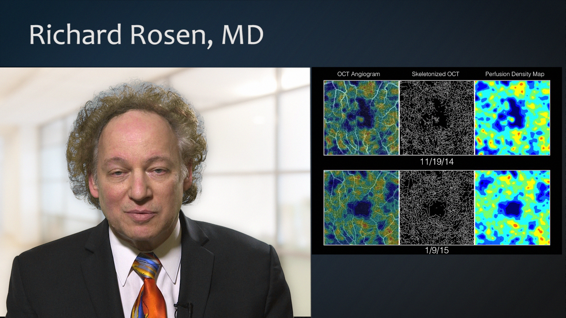 Early Detection With OCTA