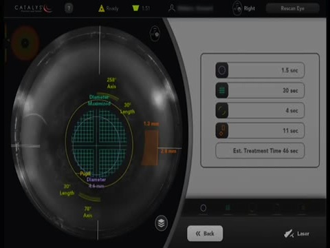 First Look at Catalys with cOS3 Software