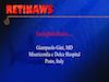 Endophthalmitis