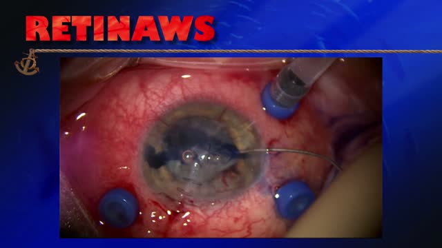 When You Need an Endoscope