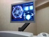 HD Cataract Surgery at EyeCare 20 20 - LenSx Thru Surgeon's Eyes